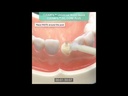 Клірфіл Універсал Бонд Квік (CLEARFIL Universal Bond Quick)