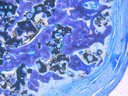 Гранули Maxresorb (Botiss biomaterials)